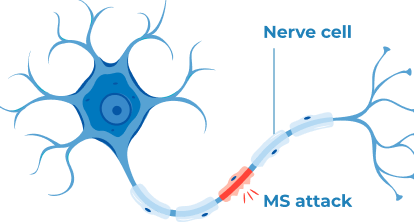 MS attacking nerve cell illustration