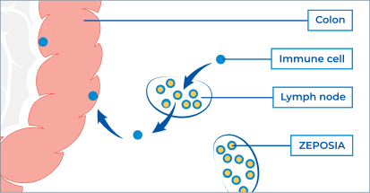 ZEPOSIA® for UC is thought to act as gatekeeper illustration